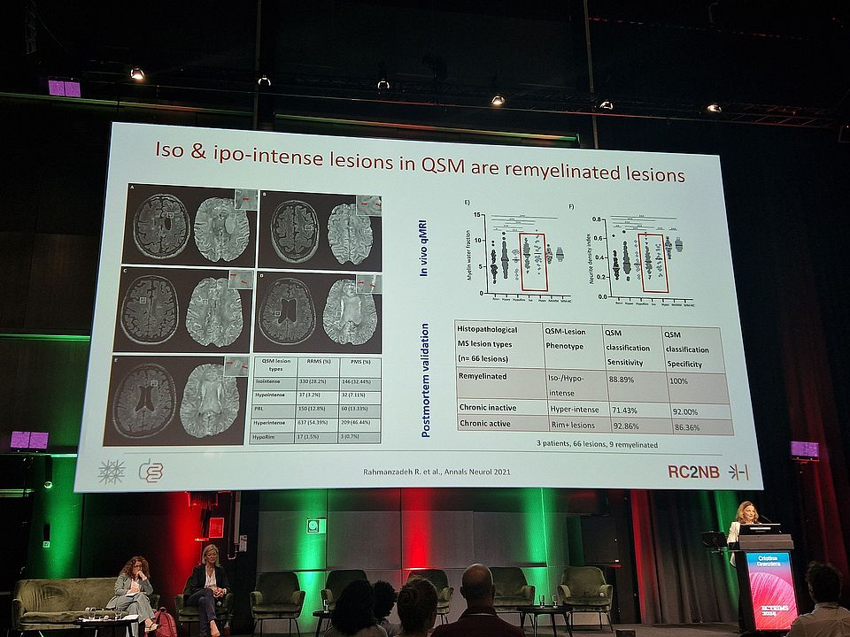 Prof. Cristina Granziera presenting at ECTRIMS 2024 